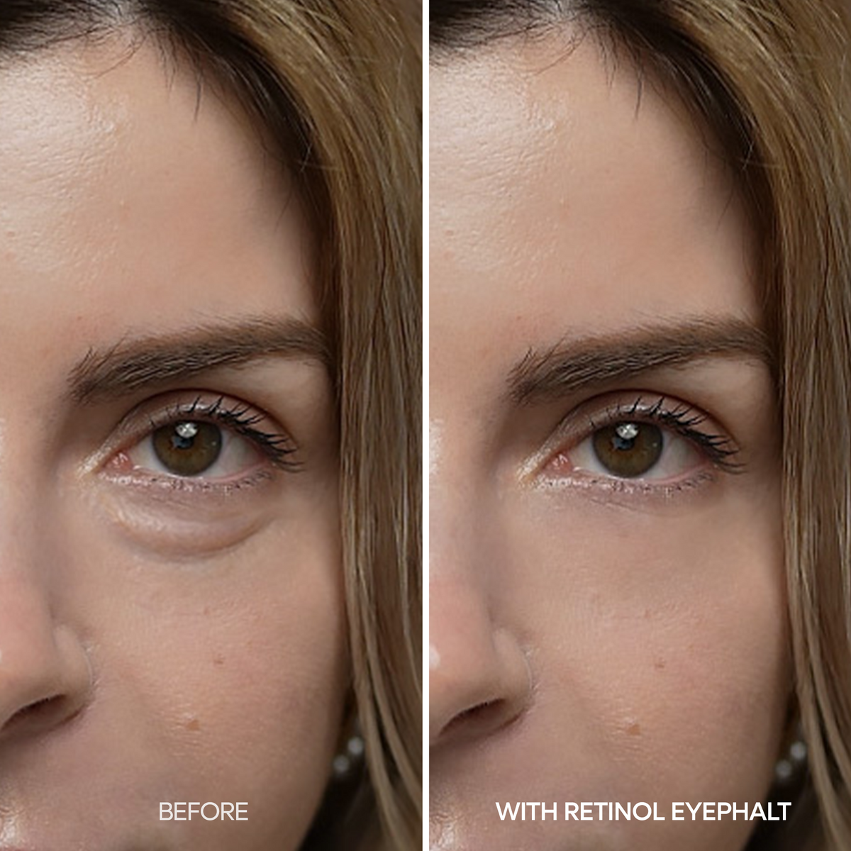 Dr.Melaxin – Retinol Eyebag Cream -10g – papildomas gamintojo vaizdas