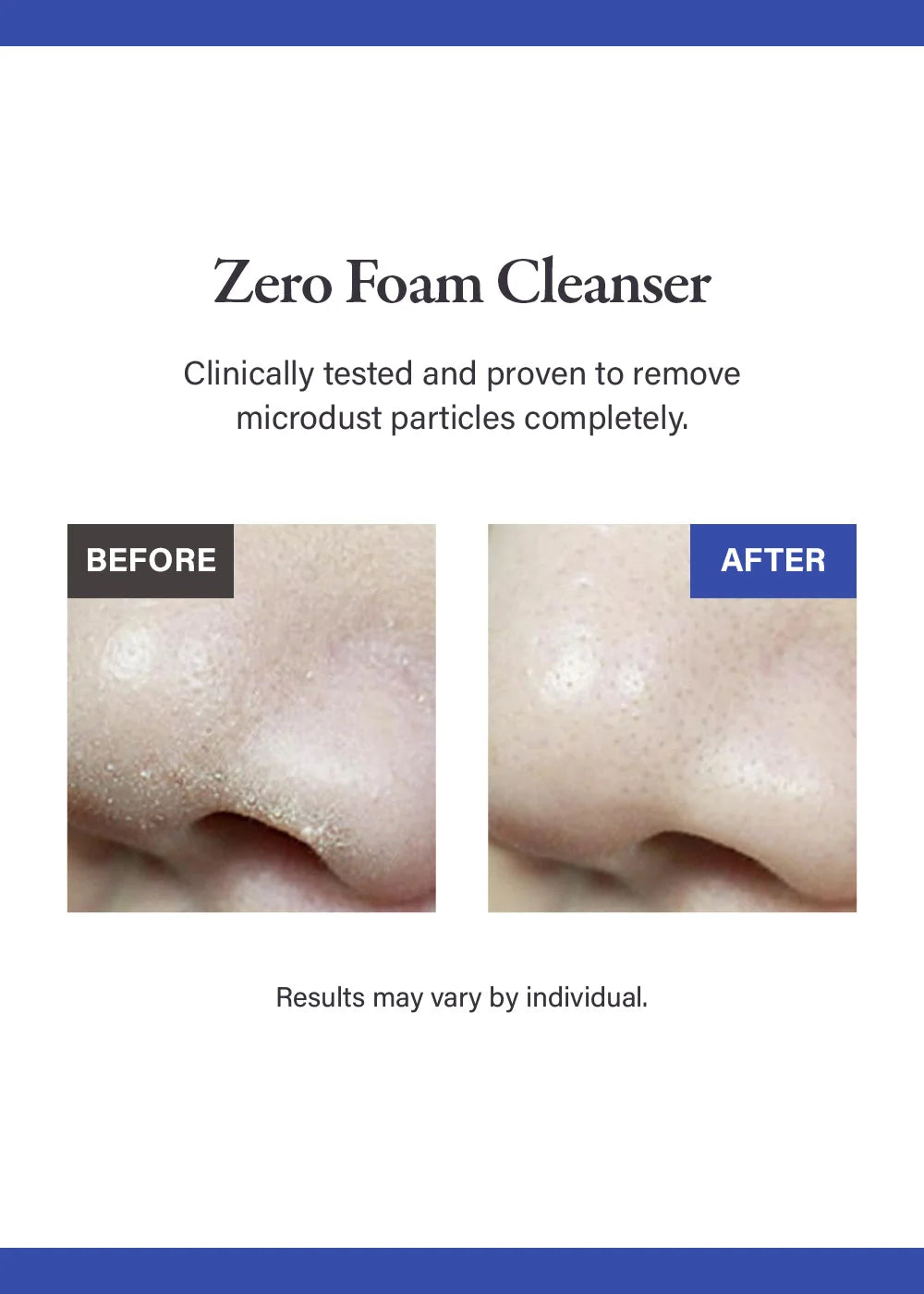 Medicube – Zero Foam Cleanser, 120g