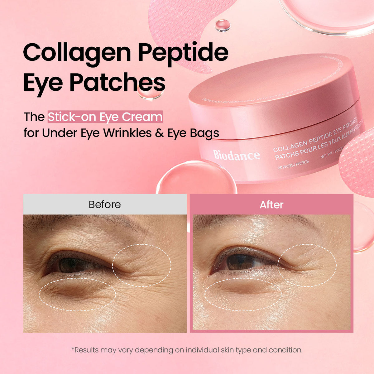 Biodance Collagen Peptide Eye Patches, 30pcs – papildomas gamintojo vaizdas