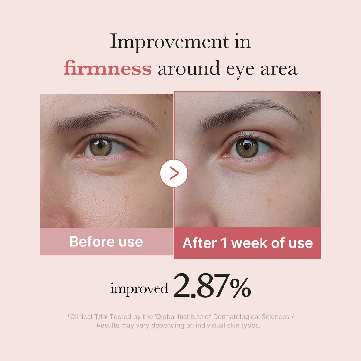 Medicube PDRN Pink Peptide Eye Cream, 30 ml – papildomas gamintojo vaizdas