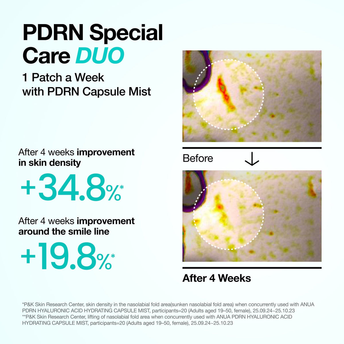 ANUA PDRN Collagen Melting Patch for Glass Skin, 4pcs – papildomas gamintojo vaizdas